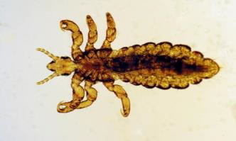 Pediculus capitis